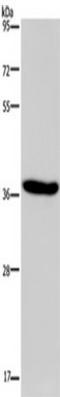 Potassium Two Pore Domain Channel Subfamily K Member 17 antibody, TA350110, Origene, Western Blot image 