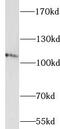 IQ Motif And Sec7 Domain 1 antibody, FNab10511, FineTest, Western Blot image 