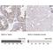 Melanoma inhibitory activity protein 3 antibody, NBP2-33770, Novus Biologicals, Immunohistochemistry paraffin image 