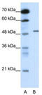 Gamma-Aminobutyric Acid Type A Receptor Beta2 Subunit antibody, TA338508, Origene, Western Blot image 