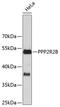 Protein Phosphatase 2 Regulatory Subunit Bbeta antibody, 23-751, ProSci, Western Blot image 