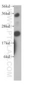Adenylate kinase isoenzyme 1 antibody, 14978-1-AP, Proteintech Group, Western Blot image 