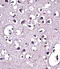 Lipoprotein lipase antibody, 57-531, ProSci, Immunohistochemistry paraffin image 