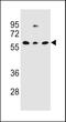 C-Type Lectin Domain Containing 17A antibody, LS-C203725, Lifespan Biosciences, Western Blot image 
