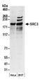 Nuclear Receptor Coactivator 3 antibody, A300-347A, Bethyl Labs, Western Blot image 