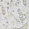 Ubiquitin Protein Ligase E3C antibody, 22-225, ProSci, Immunohistochemistry paraffin image 