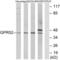 G Protein-Coupled Receptor 52 antibody, LS-B4959, Lifespan Biosciences, Western Blot image 
