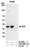 Deoxycytidine kinase antibody, A304-266A, Bethyl Labs, Immunoprecipitation image 