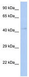 Transcription Factor Dp Family Member 3 antibody, TA330180, Origene, Western Blot image 