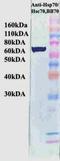 Heat Shock Protein Family A (Hsp70) Member 8 antibody, TA309383, Origene, Western Blot image 