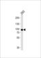 Cytosolic phospholipase A2 antibody, LS-C163759, Lifespan Biosciences, Western Blot image 