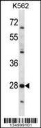 Serine Protease 27 antibody, 58-048, ProSci, Western Blot image 