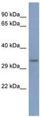 Poly(RC) Binding Protein 3 antibody, TA343897, Origene, Western Blot image 