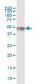 Zinc Finger Protein 772 antibody, H00400720-B01P, Novus Biologicals, Western Blot image 