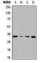 Cyclin D1 antibody, LS-C358449, Lifespan Biosciences, Western Blot image 