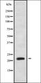 H/ACA ribonucleoprotein complex subunit 1 antibody, orb336266, Biorbyt, Western Blot image 