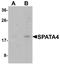 Spermatogenesis-associated protein 4 antibody, A15127, Boster Biological Technology, Western Blot image 