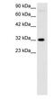 Mesenchyme Homeobox 1 antibody, PA1-24468, Invitrogen Antibodies, Western Blot image 
