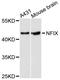 Nuclear Factor I X antibody, A9390, ABclonal Technology, Western Blot image 