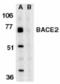 Beta-secretase 2 antibody, TA306032, Origene, Western Blot image 