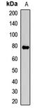 Fanconi anemia group E protein antibody, LS-C668865, Lifespan Biosciences, Western Blot image 