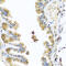 Chitinase 3 Like 2 antibody, 23-084, ProSci, Immunohistochemistry frozen image 