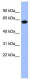 Kelch Like Family Member 8 antibody, TA345296, Origene, Western Blot image 