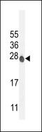 V-type proton ATPase 16 kDa proteolipid subunit antibody, MBS9212545, MyBioSource, Western Blot image 