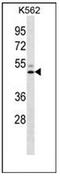 Hepatic lipase antibody, AP52492PU-N, Origene, Western Blot image 