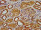 Elongator complex protein 3 antibody, CSB-PA884499LA01HU, Cusabio, Immunohistochemistry paraffin image 