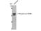 LYN Proto-Oncogene, Src Family Tyrosine Kinase antibody, A01424Y508, Boster Biological Technology, Western Blot image 
