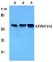 ATPase H+ Transporting V1 Subunit B1 antibody, A06073-1, Boster Biological Technology, Western Blot image 