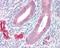 ADAM Metallopeptidase Domain 33 antibody, GTX104804, GeneTex, Immunohistochemistry paraffin image 
