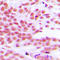 p65 antibody, LS-C354088, Lifespan Biosciences, Immunohistochemistry paraffin image 