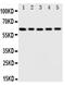 Iduronate 2-Sulfatase antibody, PA1917, Boster Biological Technology, Western Blot image 