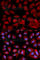 Proteasome 26S Subunit, ATPase 4 antibody, A2505, ABclonal Technology, Immunofluorescence image 