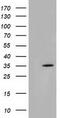 Short Chain Dehydrogenase/Reductase Family 9C Member 7 antibody, M13978, Boster Biological Technology, Western Blot image 