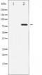 ATR-interacting protein antibody, TA325244, Origene, Western Blot image 