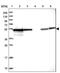 Protein Phosphatase 2 Regulatory Subunit Balpha antibody, PA5-59878, Invitrogen Antibodies, Western Blot image 