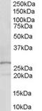 Docking Protein 5 antibody, TA302468, Origene, Western Blot image 