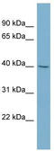 Proline Rich 5 antibody, TA345112, Origene, Western Blot image 