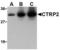 C1q And TNF Related 2 antibody, LS-C489, Lifespan Biosciences, Western Blot image 
