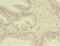 Methylenetetrahydrofolate Reductase antibody, A50390-100, Epigentek, Immunohistochemistry paraffin image 