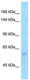 Protein Zfp708 antibody, TA329106, Origene, Western Blot image 