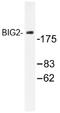 ADP Ribosylation Factor Guanine Nucleotide Exchange Factor 2 antibody, AP01387PU-N, Origene, Western Blot image 