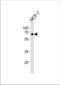 ER-beta antibody, TA324615, Origene, Western Blot image 