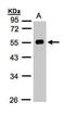 Angiotensinogen antibody, PA5-21520, Invitrogen Antibodies, Western Blot image 