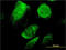 B Cell Receptor Associated Protein 29 antibody, LS-C133788, Lifespan Biosciences, Immunofluorescence image 