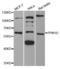 Protein Phosphatase, Mg2+/Mn2+ Dependent 1D antibody, TA332984, Origene, Western Blot image 