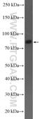 Rho GTPase-activating protein 10 antibody, 55139-1-AP, Proteintech Group, Western Blot image 